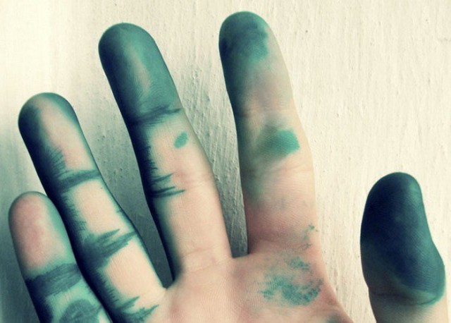 Чем отмыть зеленку с кожи рук