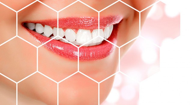 Крайности стоматологии: чем опасна «фаянсовая улыбка»?